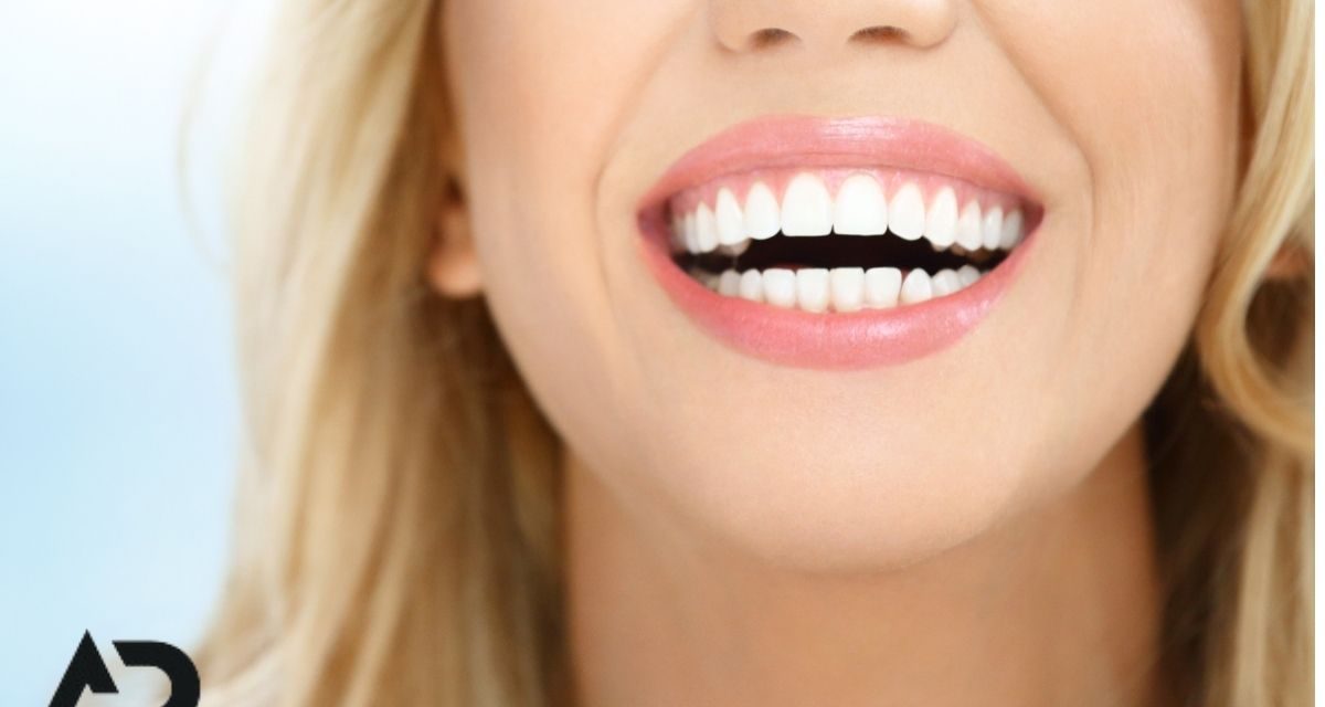 Gülüş Tasarımı: Mükemmel Gülüşe Ulaşmanın Sırları Ve Uygulama Rehberi