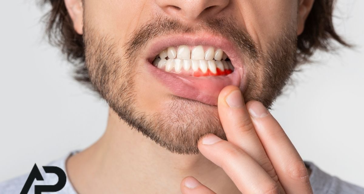 Diş İltihabı Neden Olur, Nasıl Geçer? Malatya Diş Kliniğinden Tavsiyeleri