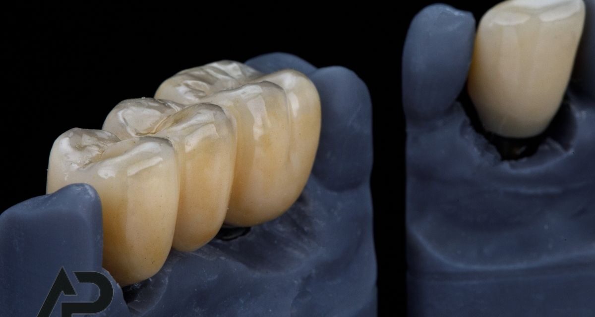 Malatya ve Elbistan’da 20’lik Diş Tedavisi: Belirtileri, Nedenleri ve Çözümleri