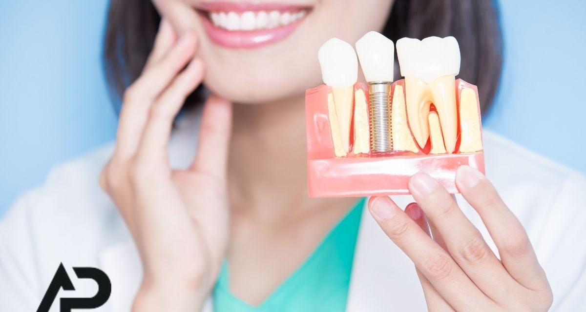 Malatya ve Elbistan’da İmplant Tedavisi: Kalıcı ve Estetik Çözümler DentAP Grup’ta